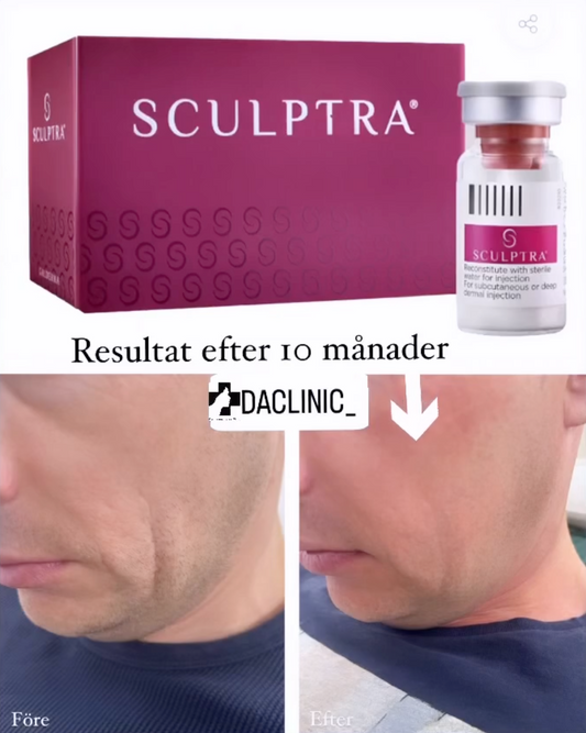 Sculptra -Kollagenstimulerande